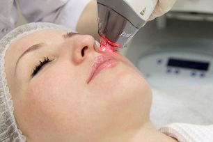 Fractional laser facial rejuvenation process