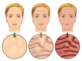 stages of skin ageing