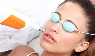 How to rejuvenate the face by fractional laser done