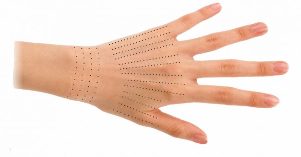 Injection sites for hands during bio-regeneration